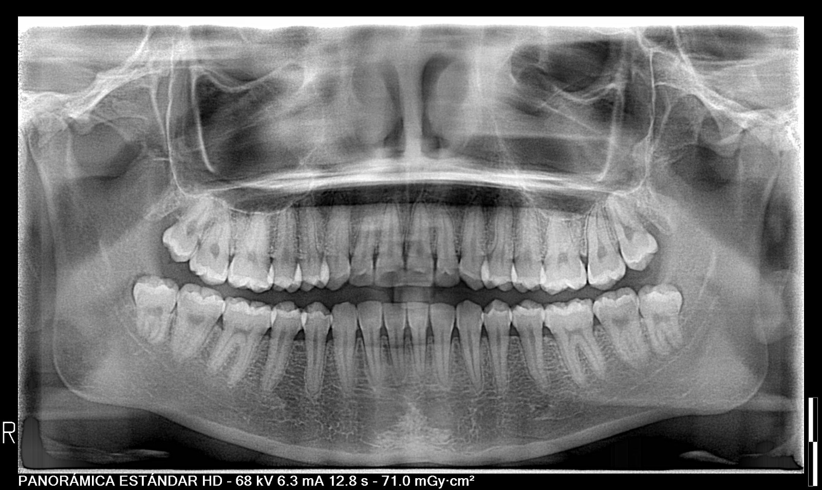 Radiología Dental